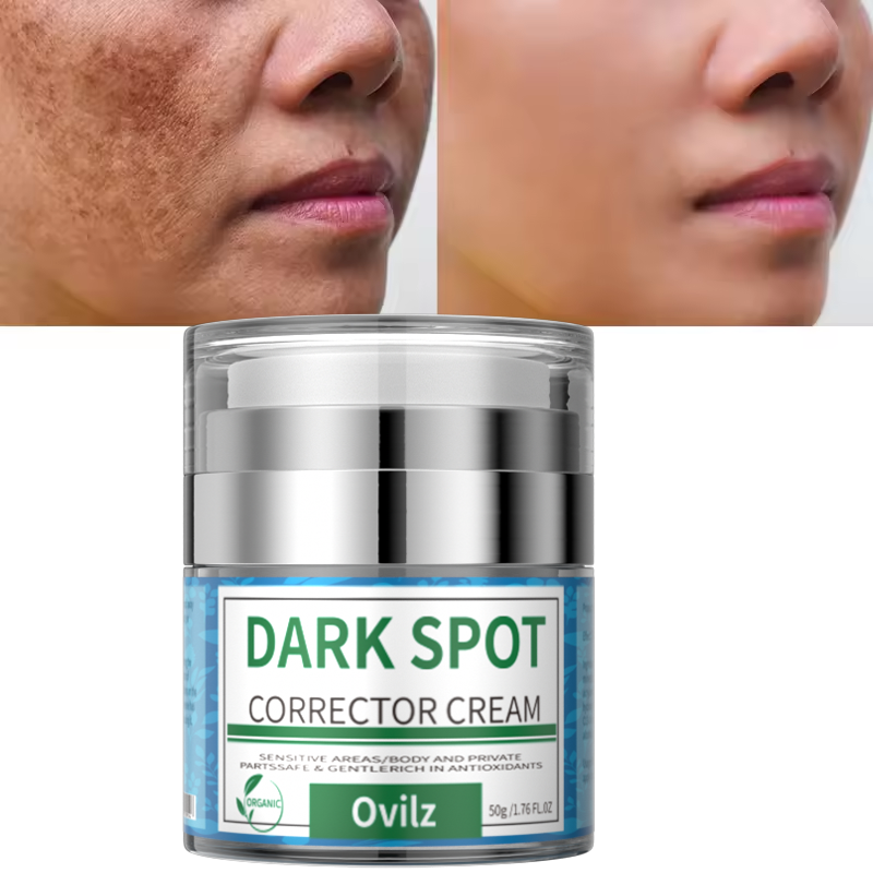 Private Label Beauty Skin Care Face Black Freckle Acne Fade Dark Spot Removing Corrector Anti Freckle Cream 
